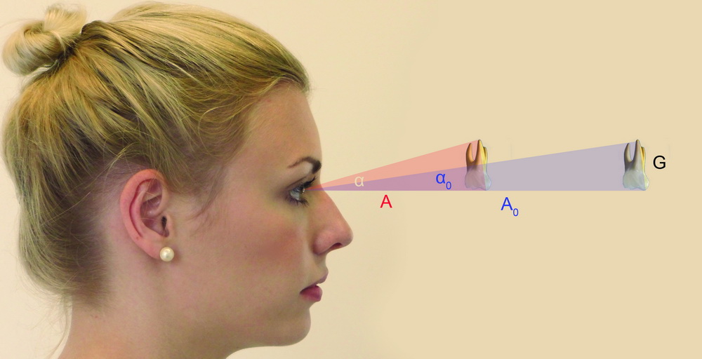 Optical beam path during magnification